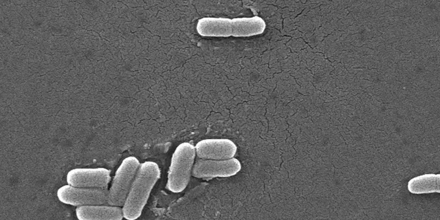 Gram-negative Escherichia coli bacteria of the strain e.coli O157 H7