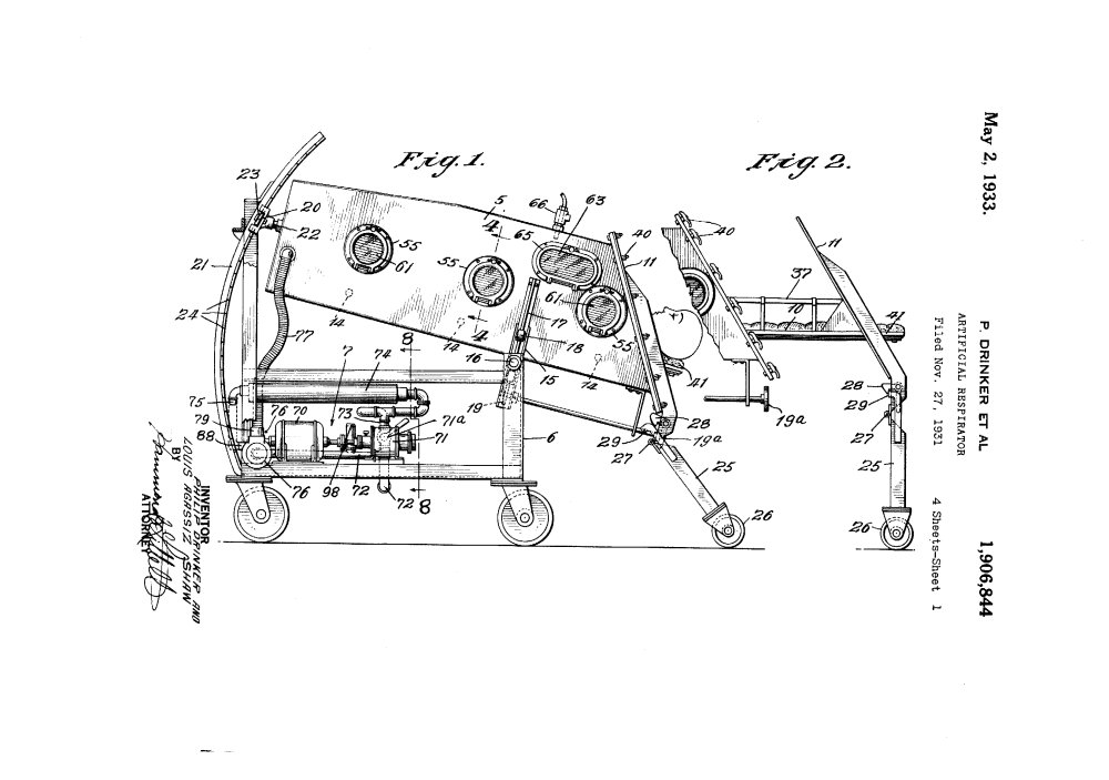 What is an iron lung?