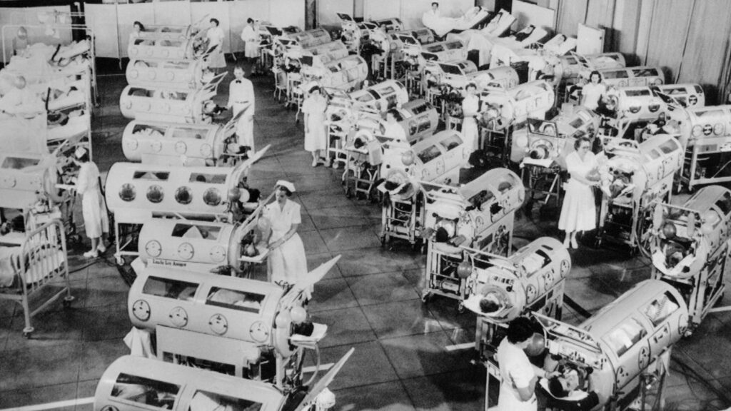 Polio patients in iron lung respirators in California in 1953. Pic: Alamy
