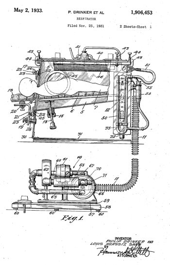 How does an iron lung work?